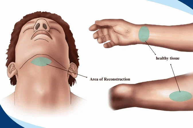 Dr Manish Tiwari Microvascular Reconstructive Surgeon