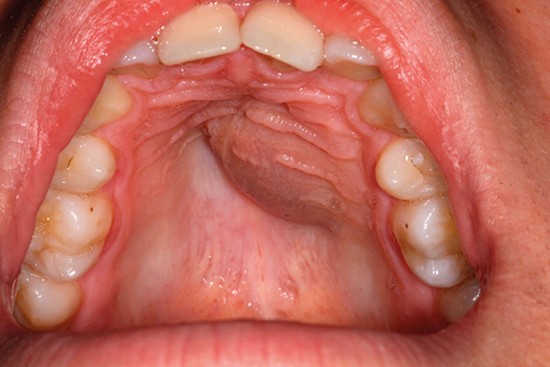 Dr Manish Tiwari Jaw Cyst Surgeon