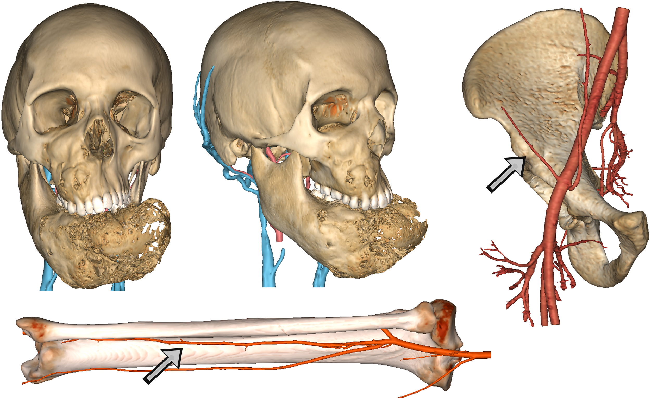 Dr Manish Tiwari Microvascular Surgeon