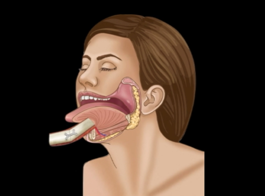 Dr Manish Tiwari Jaw Cancer Surgeon
