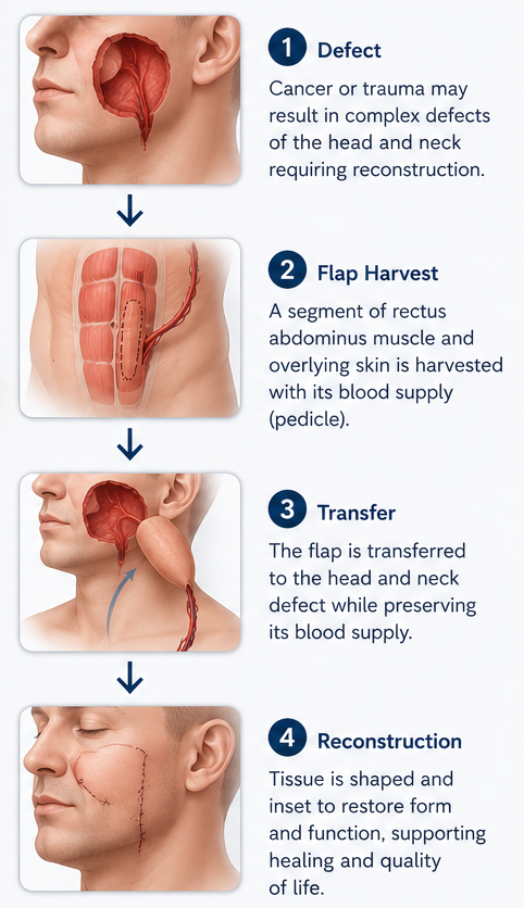 Dr Manish Tiwari Major Defect Reconstruction Surgeon
